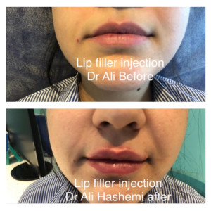 Dr Ali Hashemi - 3