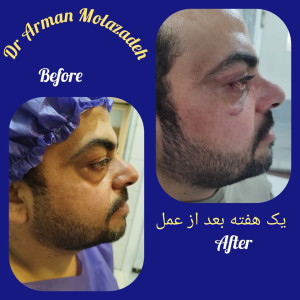دکتر آرمان مولازاده - 2