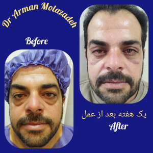 دکتر آرمان مولازاده - 3