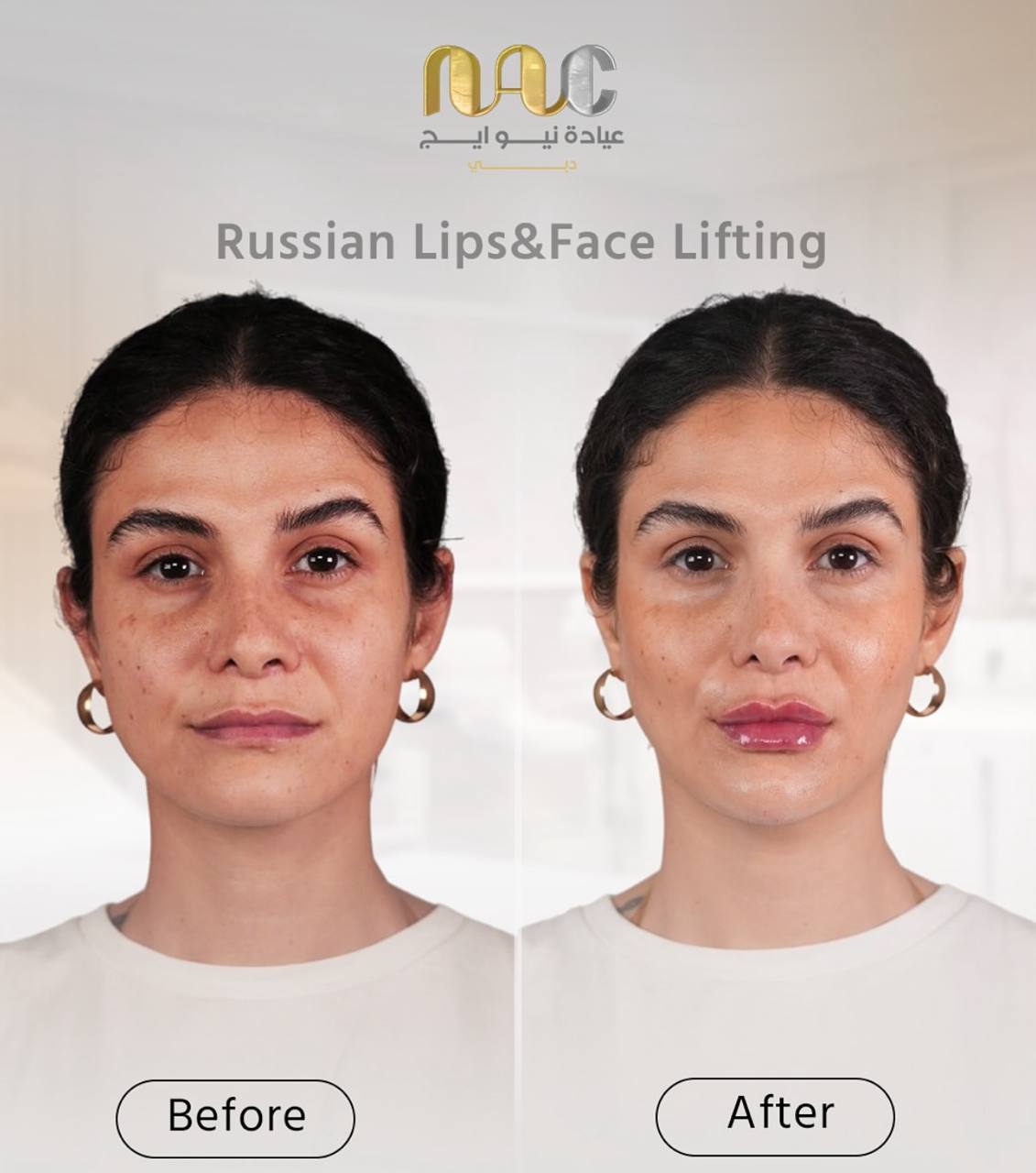 کلینیک زیبایی ناواج Dubai Nawaaj Clinic