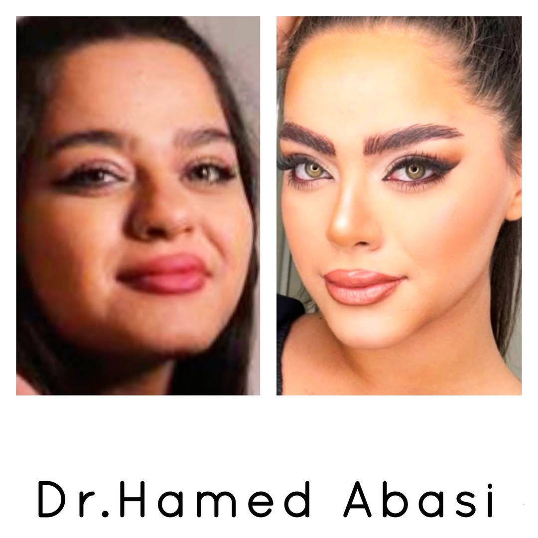 دکتر حامد عباسی